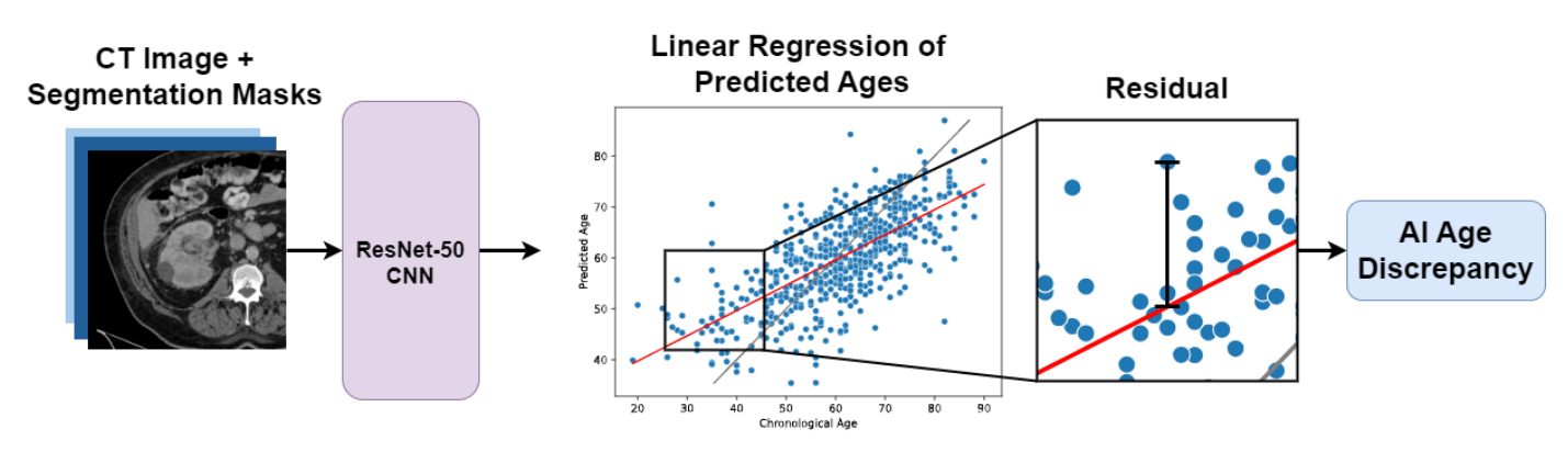 AI Age Discrepancy research visualization showing machine learning analysis of kidney tumor CT scans for frailty assessment